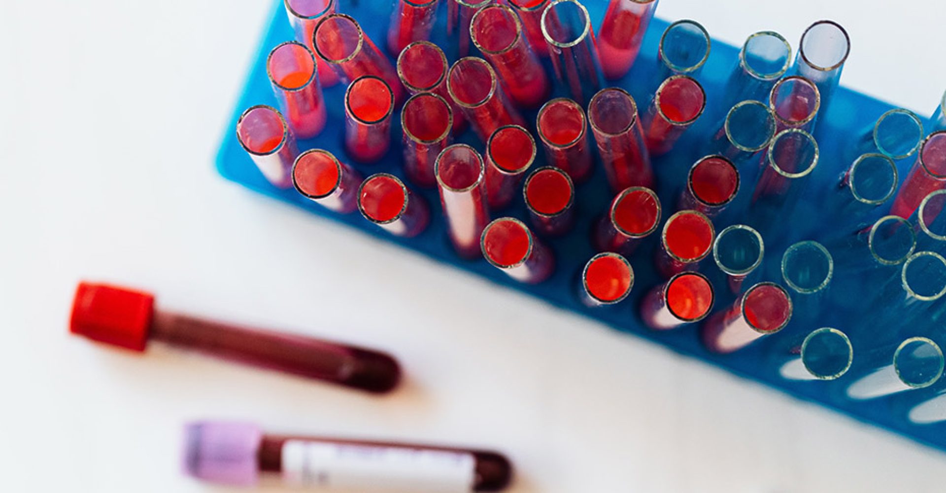 1617811510840sangreEst