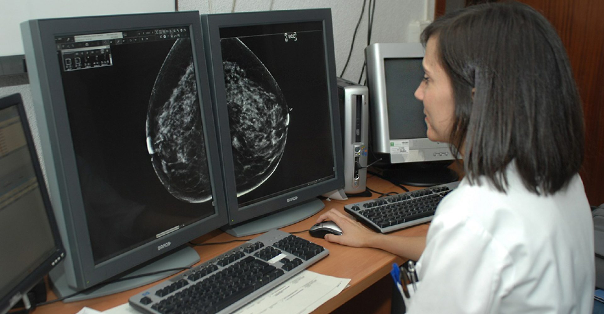 1688984038681mamografiaEst