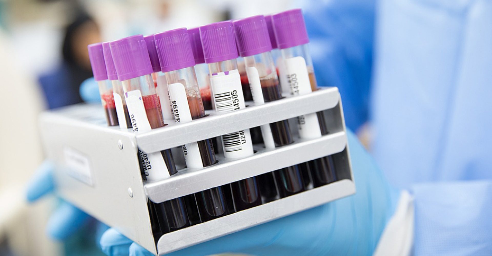 1713343096677AnalisisSangre_Estandar