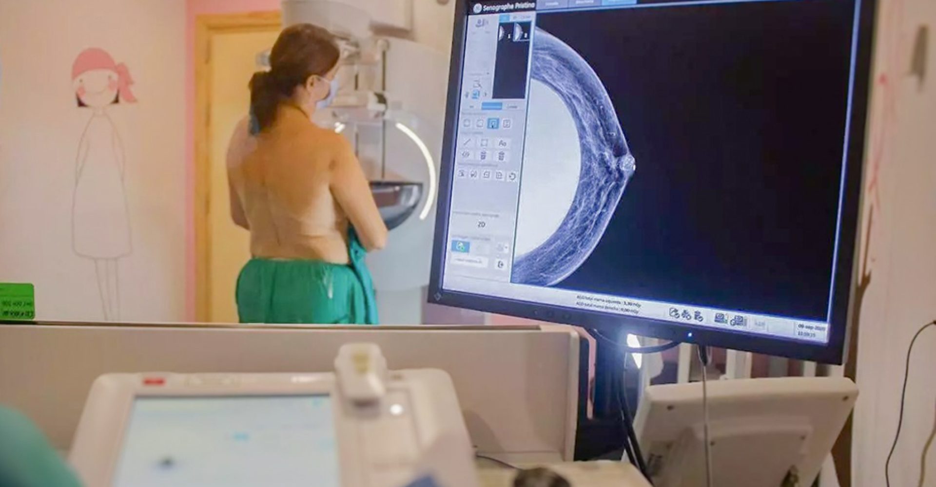 1729257160510mamografiaEst