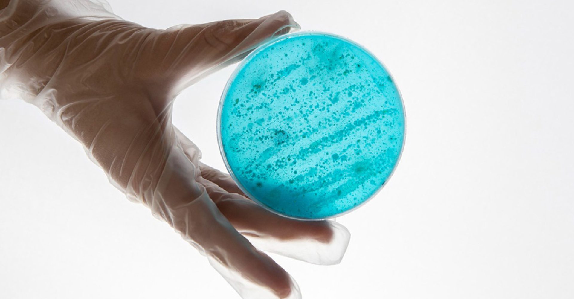 1742918598986Sarampion_Est