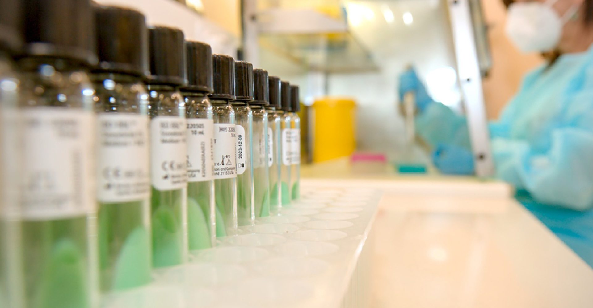 1745339935037sarampion_Est