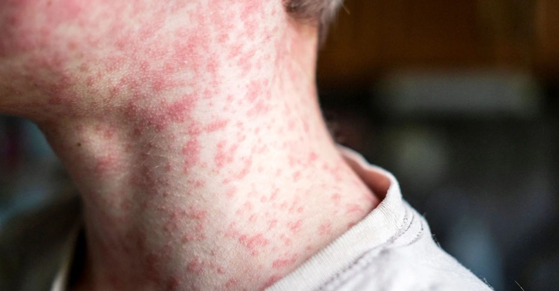 1751986772236SarampioRecurso_Est