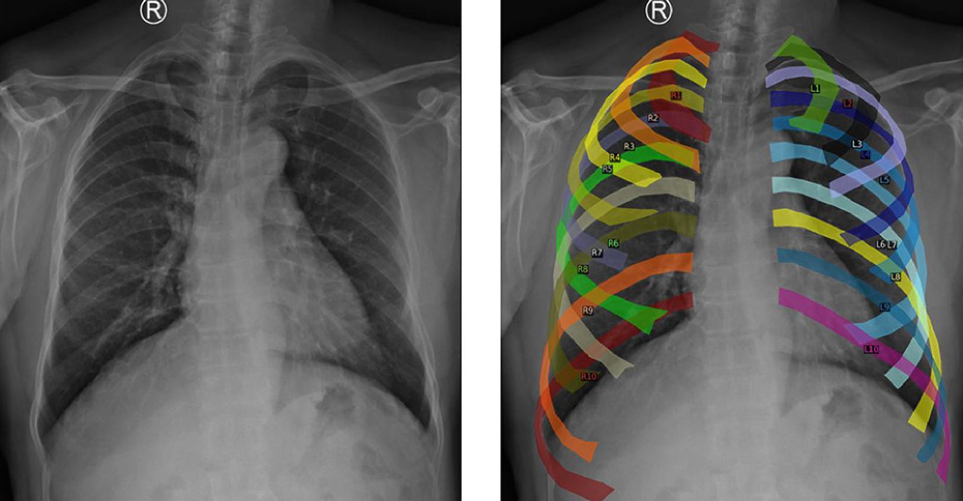 1762942694228radiografiaEst