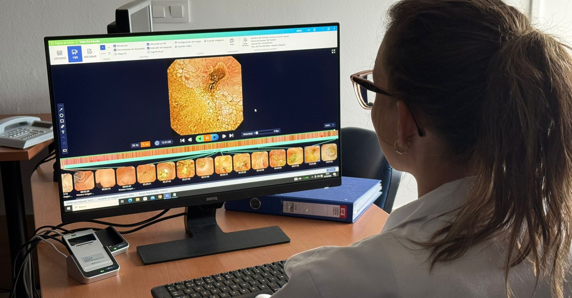 Cápsula endoscópica HUPR